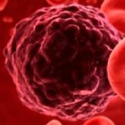 Is there a cure for blood cancer? How to cure blood cancer?