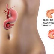 How and where the pancreas hurts - symptoms, causes, treatment