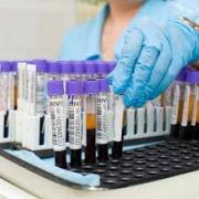 آزمایش خون عمومی: شاخص ها، هنجارها، آماده سازی