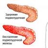 Pancreas: symptoms of diseases