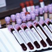 Krvný test na T4: indikácie a normy
